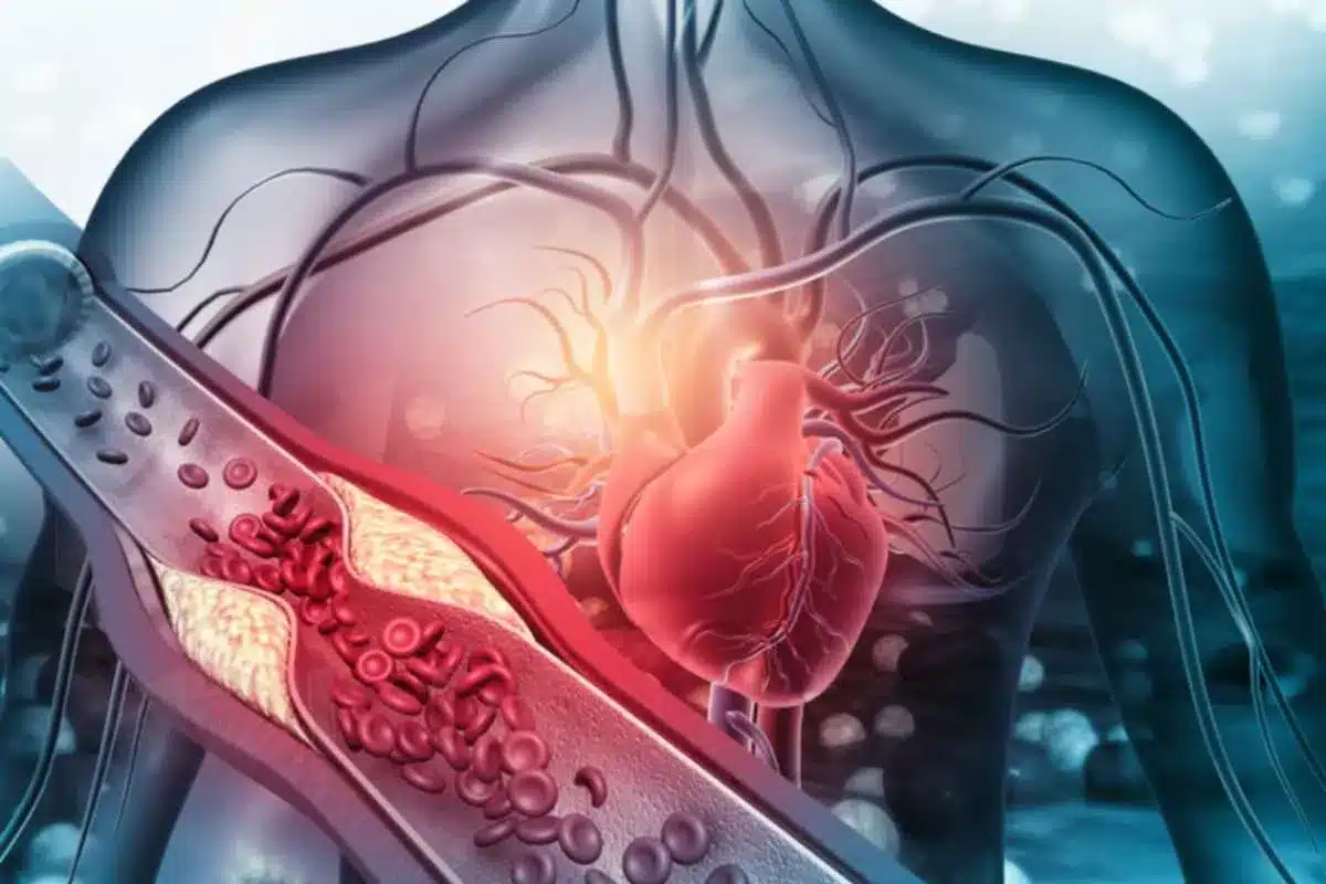 Cholesterol Reduction Habits for Cleaner Artery Health